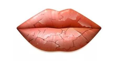 科普知识:嘴唇干裂脱皮并不全是缺水 来看看应对方法-深i科普